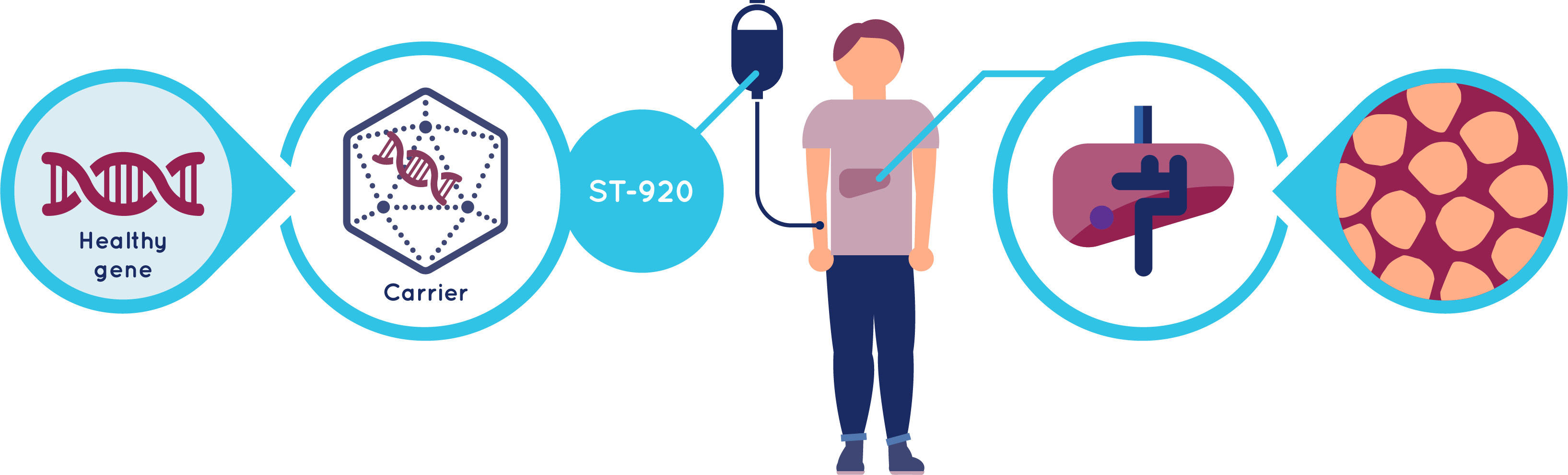 What is ST-920 and how does it work?
